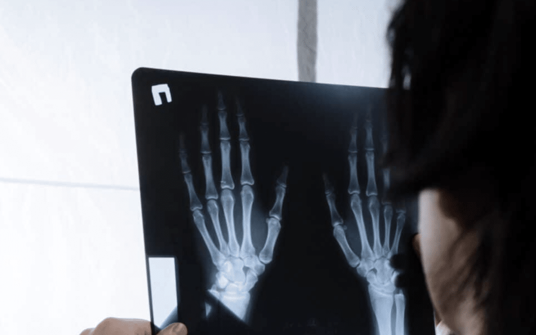 Medical Tech Examining an X-Ray